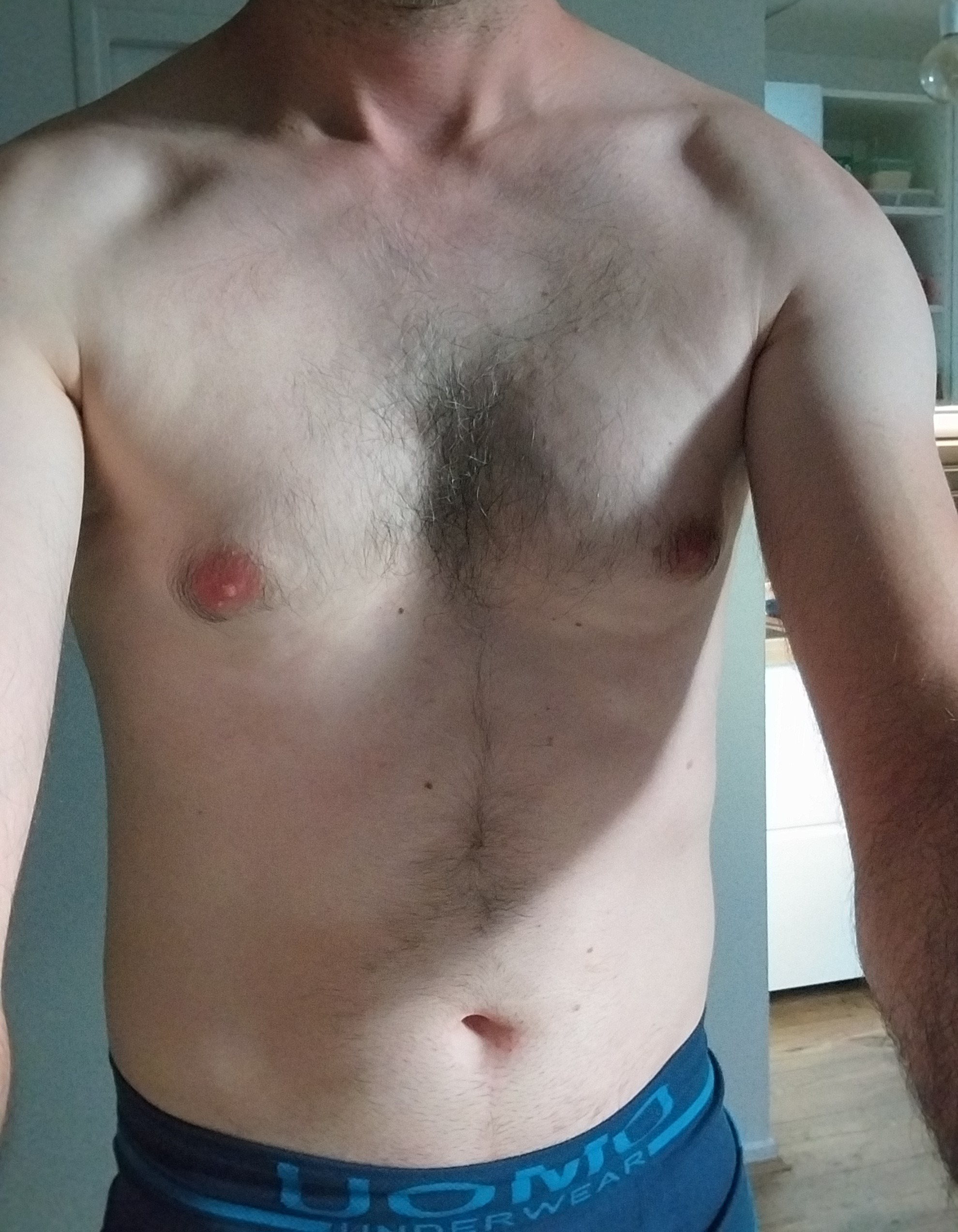 Matthyas - Durstel - Bas-Rhin | Rencontre Trans